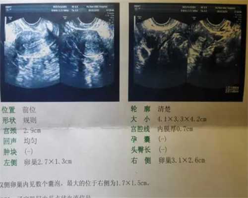 天津代怀在线咨询,天津本地供卵试管机构排名2023年天津供卵时间预估