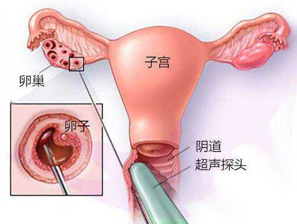 毕节地51岁做三代试管性价比_做泰国试管婴儿要尝试多少次IVF周期才能成功？