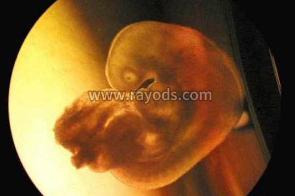 宁波私人机构做借卵试管_宁波借卵子培胎_想生小孩做试管婴儿要多长时间！听