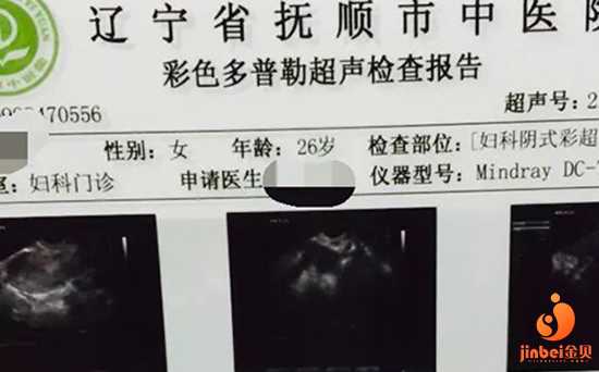 漳州49岁供卵试管的成功率_漳州43岁供卵自怀的成功率_国内供卵试管诸多限制，
