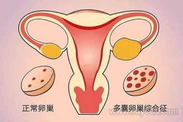 杨浦41岁供卵受孕成功率_「卵巢不好做几代试管好」开展泰国试管婴儿时大家应